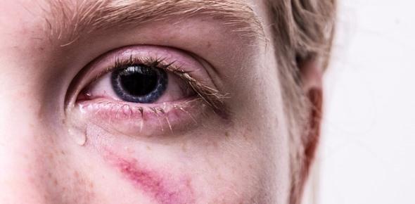 Нанесение телесных повреждений легкой и средней тяжести